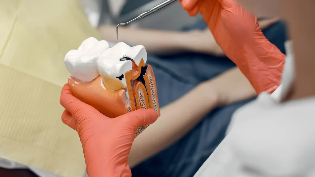 Endodontia 1 Endodontia 1