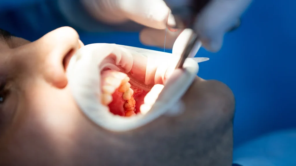 Endodontia 3 Endodontia 3