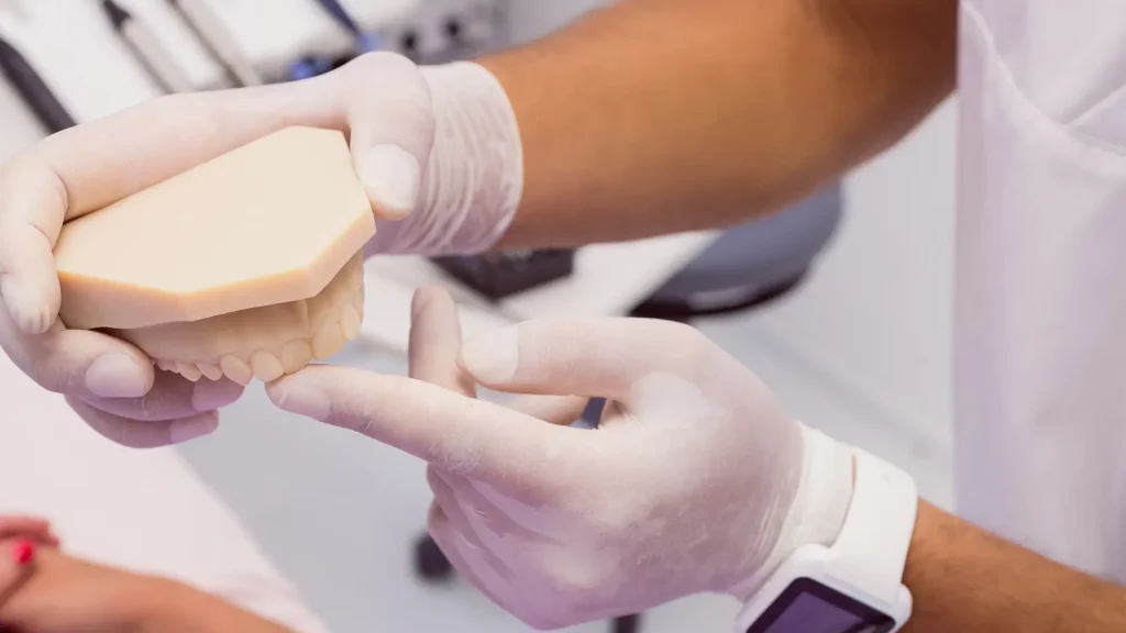 Explicação Medicina Dentária Estética Explicação Medicina Dentária Estética