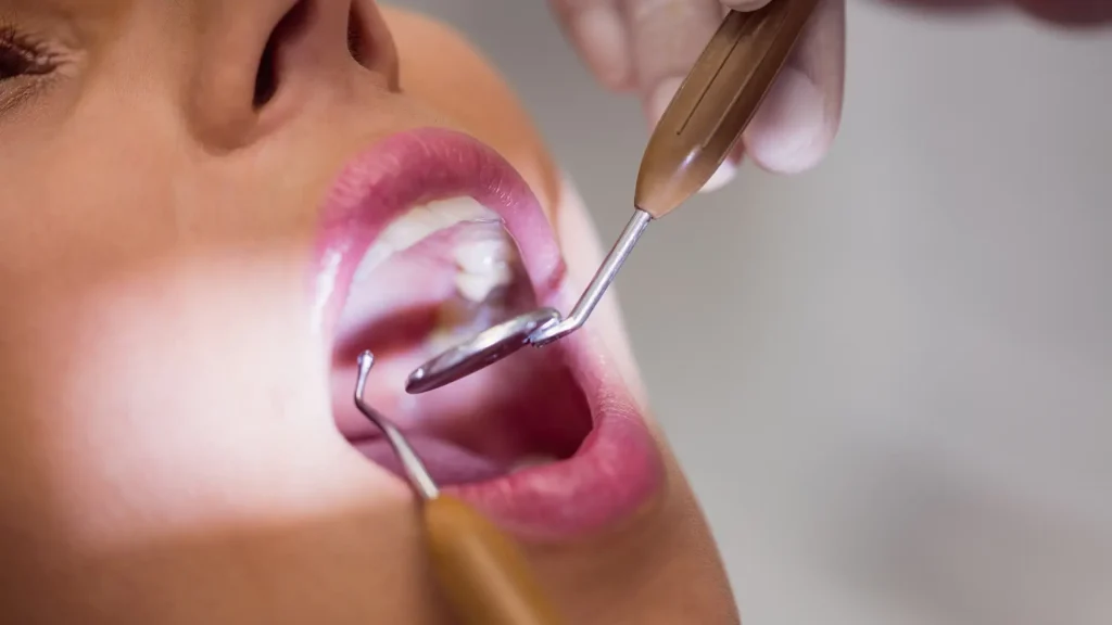 Higiene Oral Avaliação Higiene Oral Avaliação