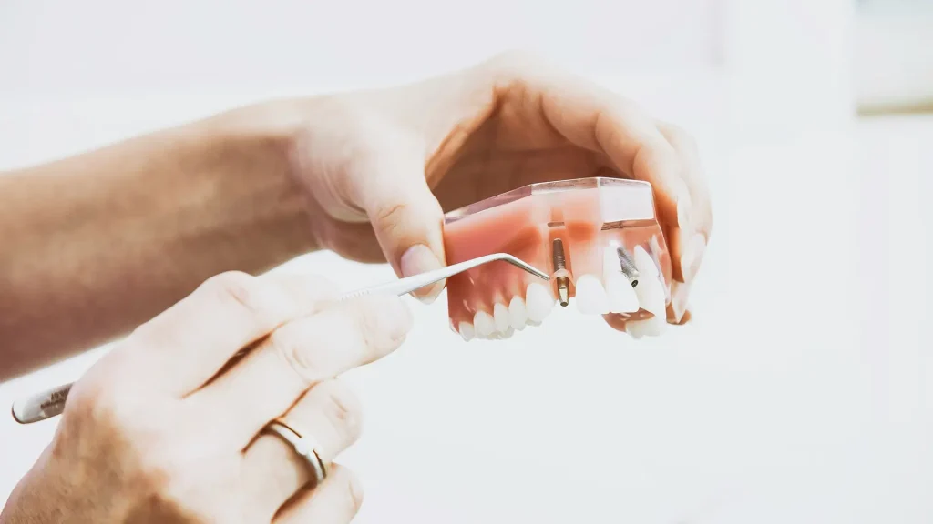 Implantes Dentários em Leiria