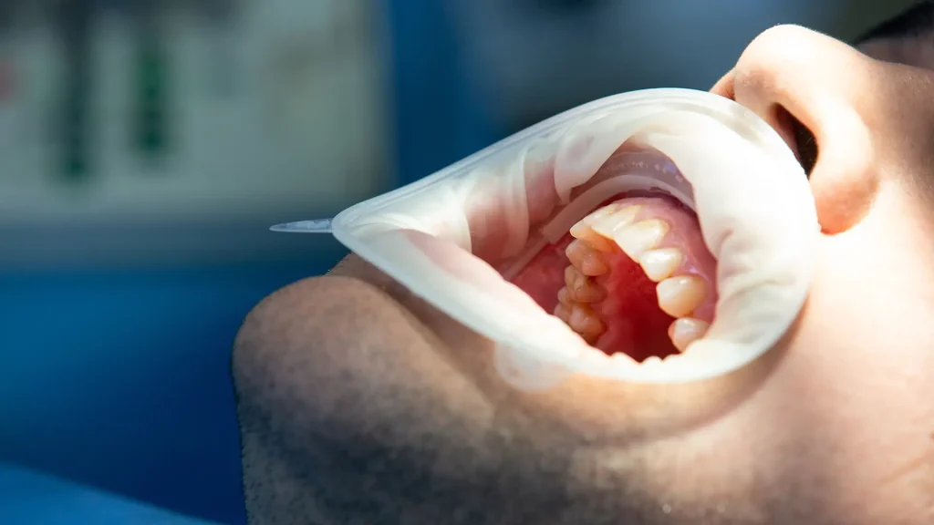 Periodontologia 4 Periodontologia 4