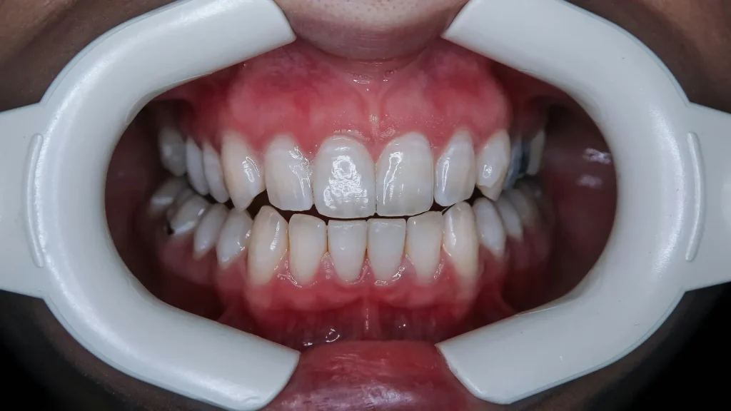 Periodontologia 5 Periodontologia 5