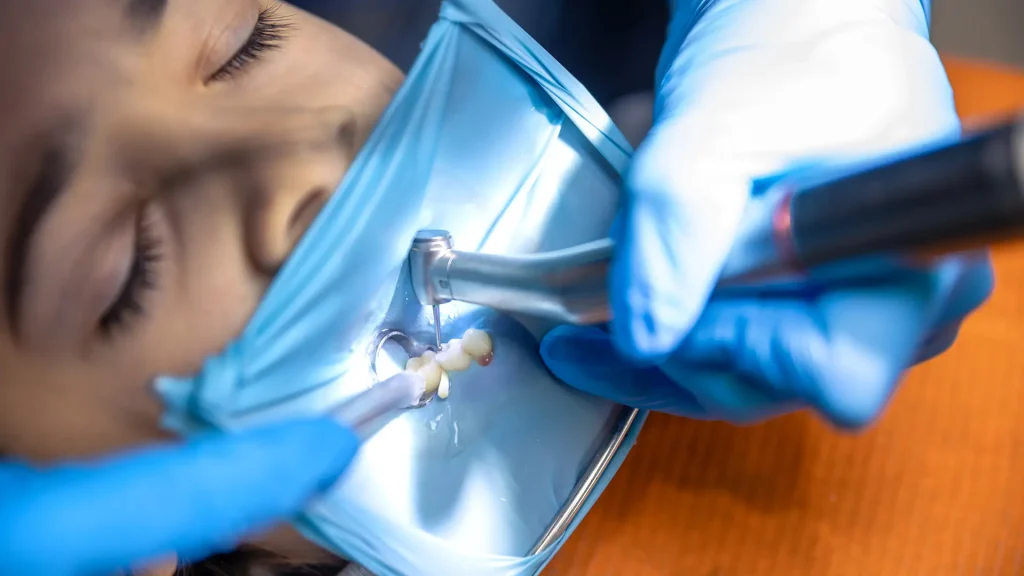 Tratamento Endodontia Tratamento Endodontia