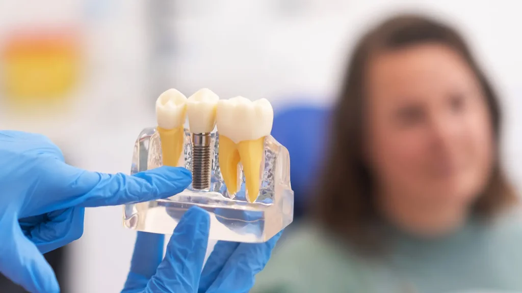 Protese Dentaria Fixa 2 Protese Dentaria Fixa 2