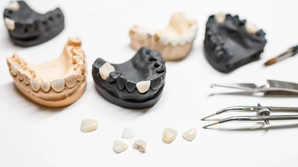 Protese Dentaria Protese Dentaria