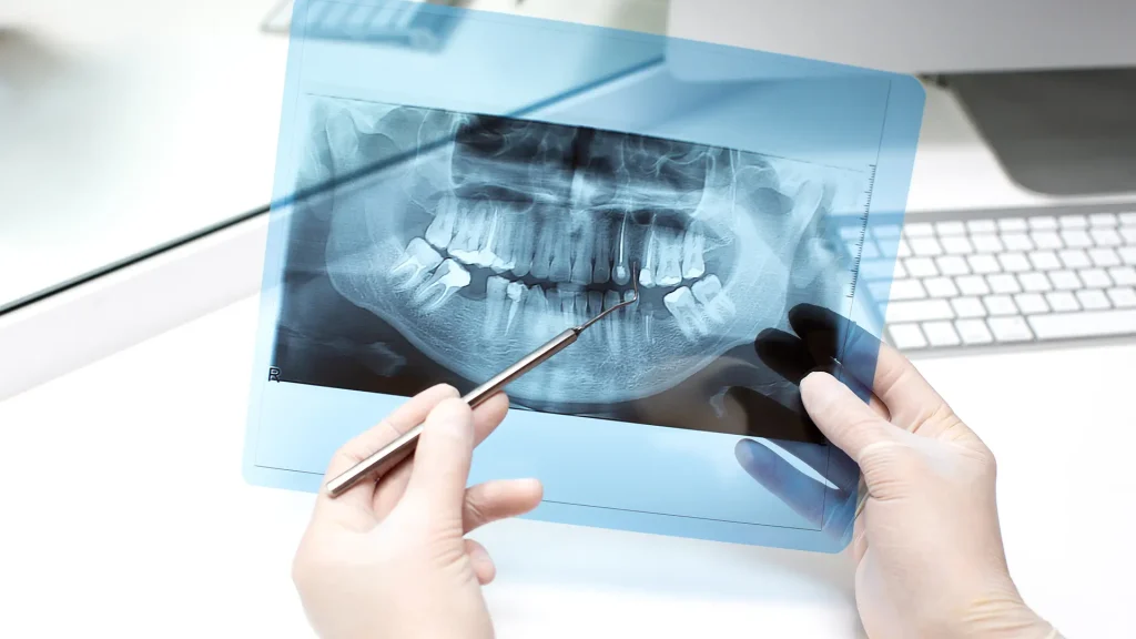 Radiologia Dentária 1