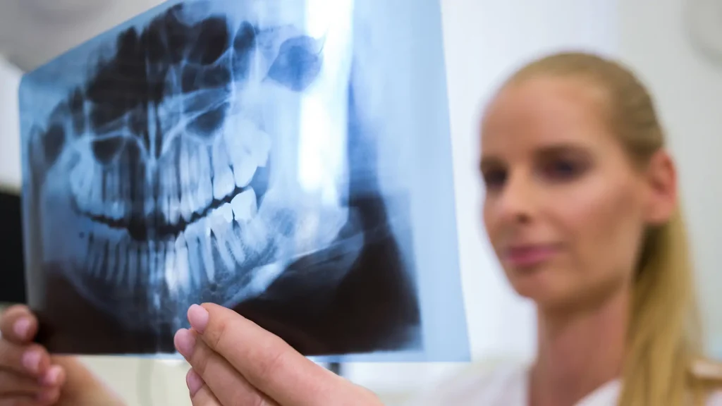 Radiologia Dentária 2